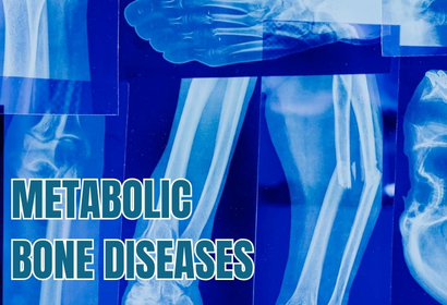 Metabolic Bone Diseases treatment by Dr Karthik Gudaru